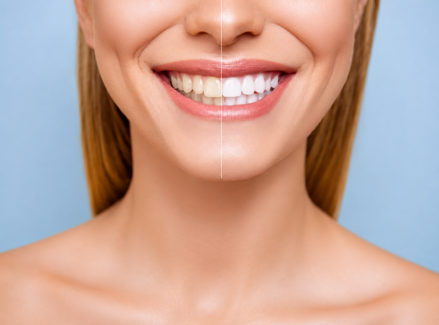 Advanced Teeth Whitening