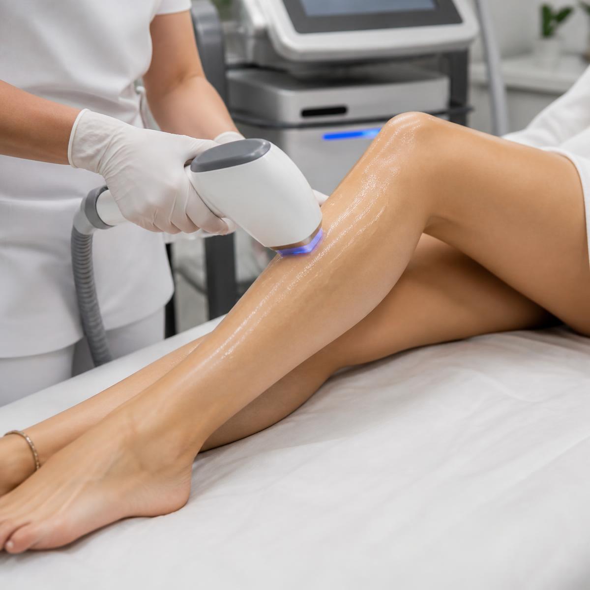Laser Hair Removal